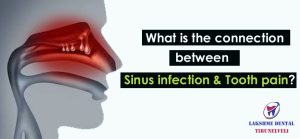 Sinus infection tooth pain | Sinus Toothache