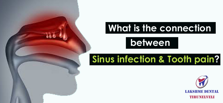 anatomy of sinus infection