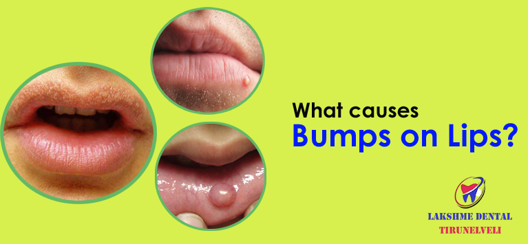 What causes bumps on lips