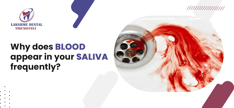 Blood In Saliva Blood In Spit Up Bloody Saliva