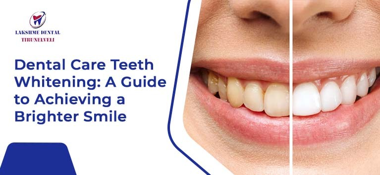 Dental Care Teeth Whitening: A Guide to Achieving a Brighter Smile