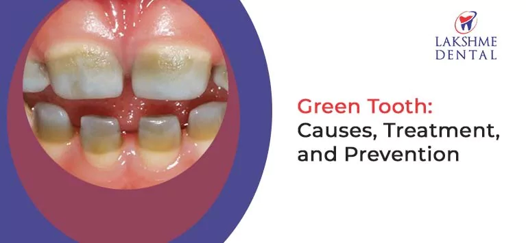 Green Tooth: Causes, Treatment, and Prevention