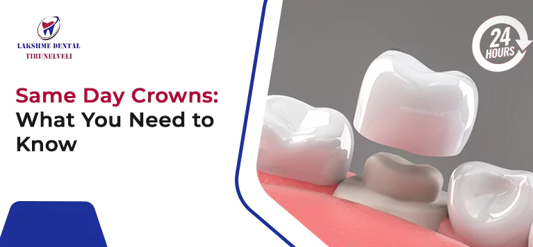 Same Day Crowns: What You Need to Know